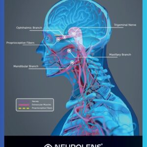 Trigeminal Nerve Graphic - EN (MKT-9071-EN 08312025)