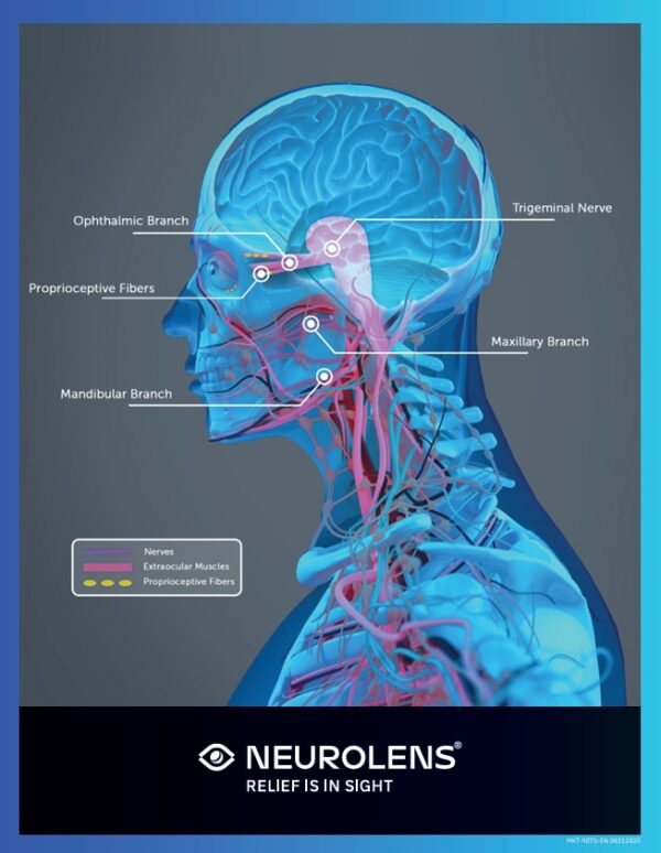Trigeminal Nerve Graphic - EN (MKT-9071-EN 08312025)