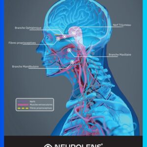 Trigeminal Nerve Graphic – FR (MKT-9071-FR 08312025)
