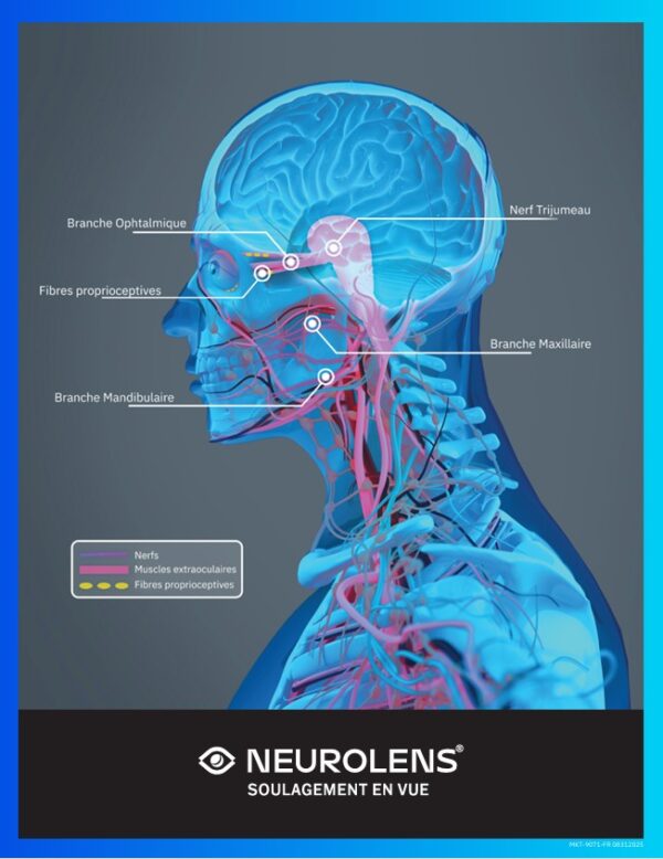 Trigeminal Nerve Graphic – FR (MKT-9071-FR 08312025)